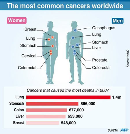 the characteristics of prostate cancer the second most common cause of death in men the characteristics of prostate cancer the second most common cause of death in men